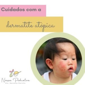 Dermatite Atópica